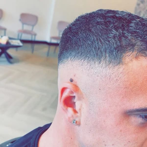 Donkere fade met scherpe contour bij het oor