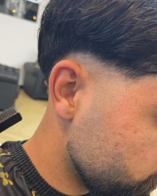 Donkere taper in de nek, close-up